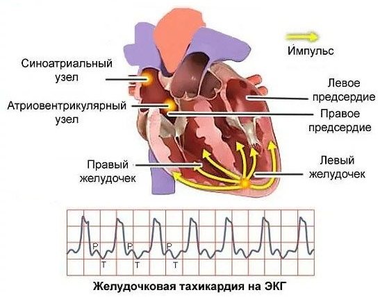 Тахикардия может стать побочным эффектом приема Окситена