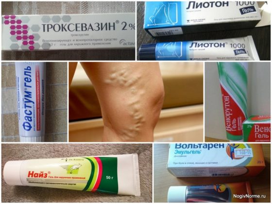 Гели от варикоза вен на ногах - обзор эффективных средств, отзывы