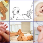 Гимнастика при косолапии у новорожденного