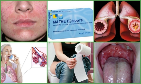 Магне В6 - осложнения