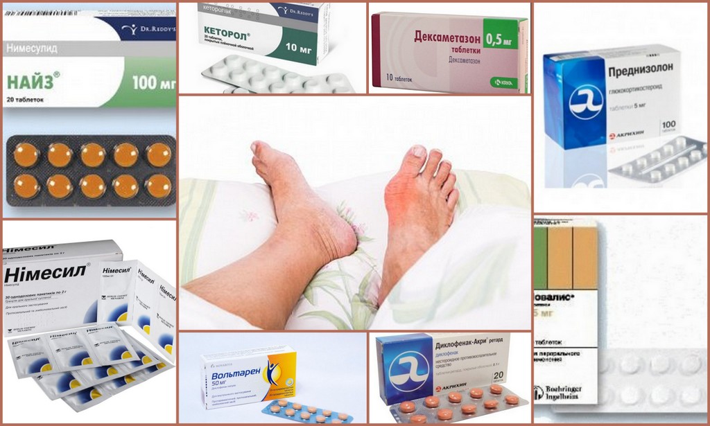 В ноги можно обезболить. Эффективное обезболивающее средство при болях в уколах. Обезболивающие средства при болях в суставах ног таблетки. Обезболивающие препараты при подагре. Обезболивающие препараты от подагры.