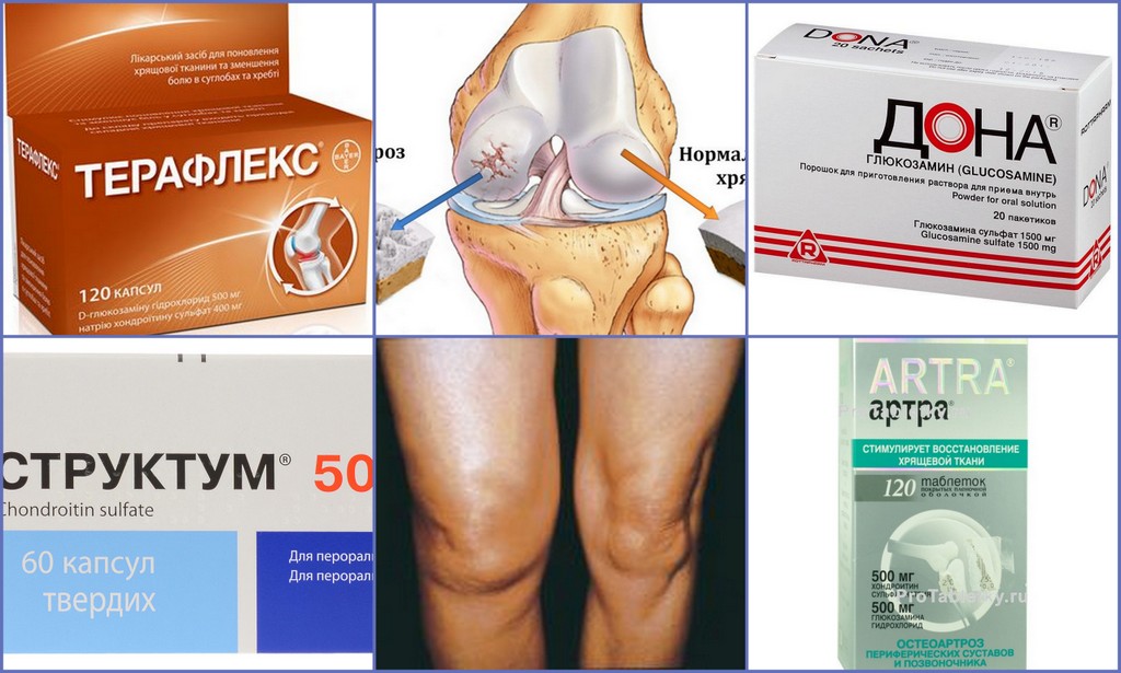 Эффективные препараты для суставов. Препараты при остеоартрите коленного сустава. Таблетки от артрита суставов артра. Таблетки от артрита коленного суставов структум. Препараты при артрозе коленного сустава 1.