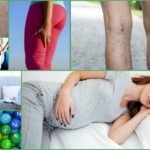 Причины онемения ног при беременности