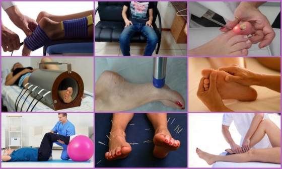 Распространённые методики устранения онемения пальцев на ногах