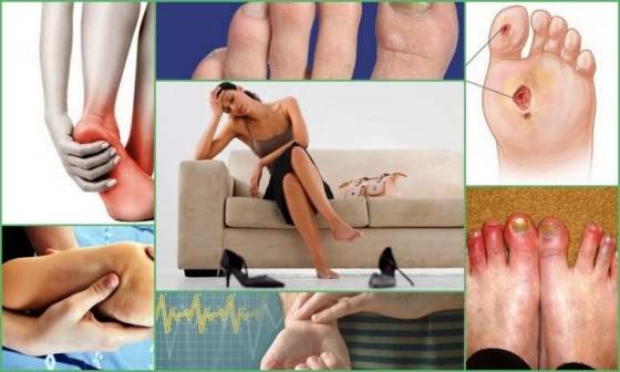 Симптоматика, сопутствующая онемению пальцев ног