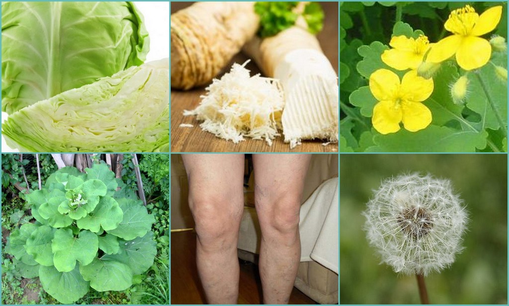 Лопух лечение суставов. Примочки из трав на суставах. Сочное растение для лечения суставов. Самое важное растение при артрозе.