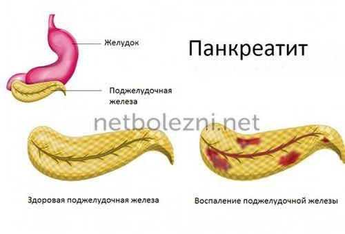 После энтеросгеля частый стул