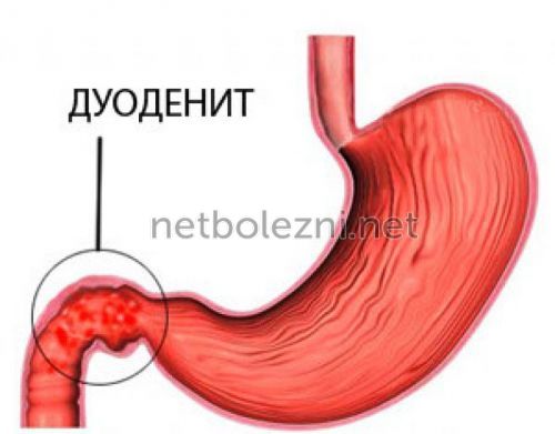 После энтеросгеля частый стул