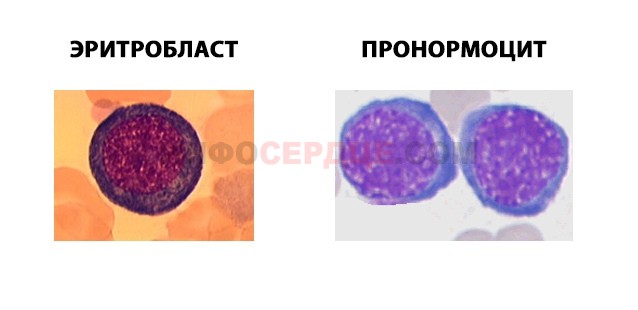 Нормобласты в крови картинки